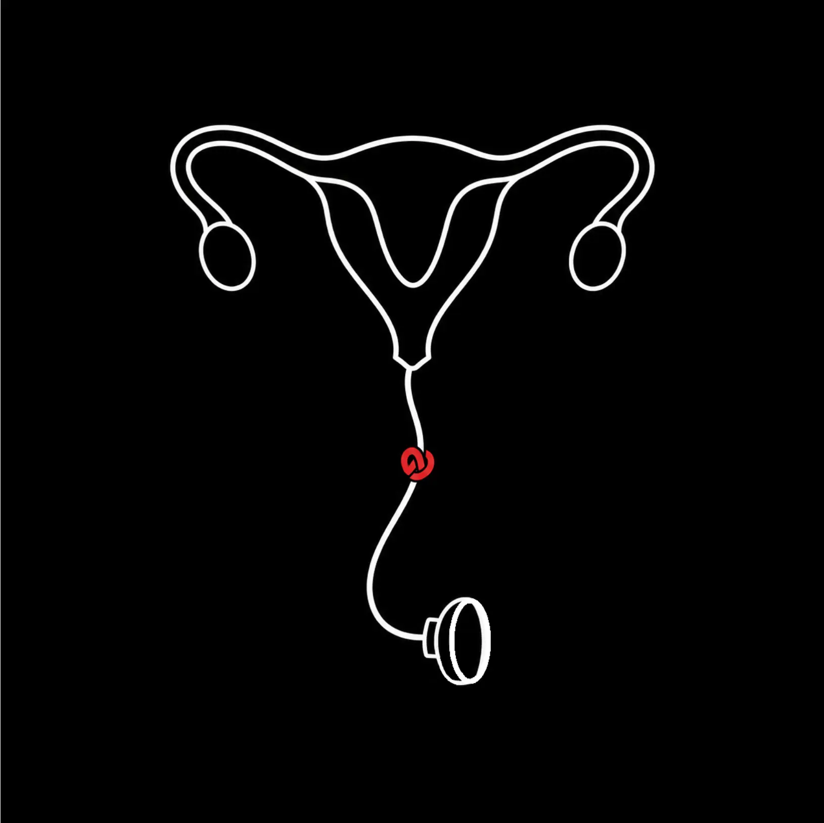 Violences obstétricales ou gynécologiques