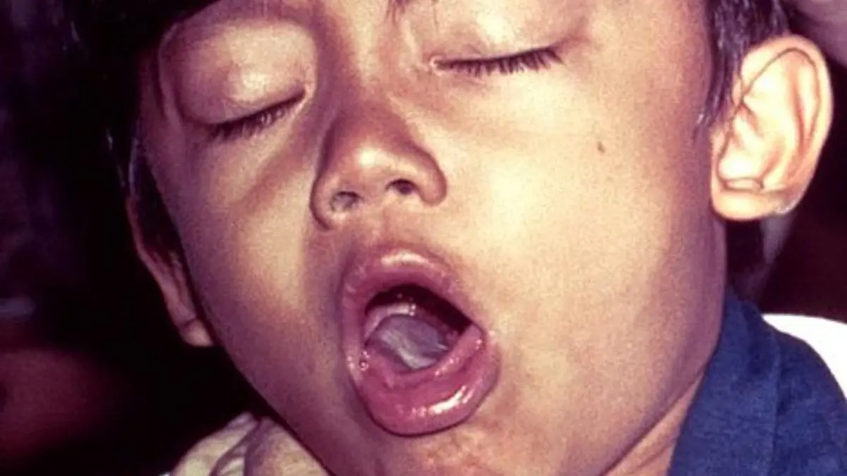 Vacciner tous les enfants contre la grippe ? Non !